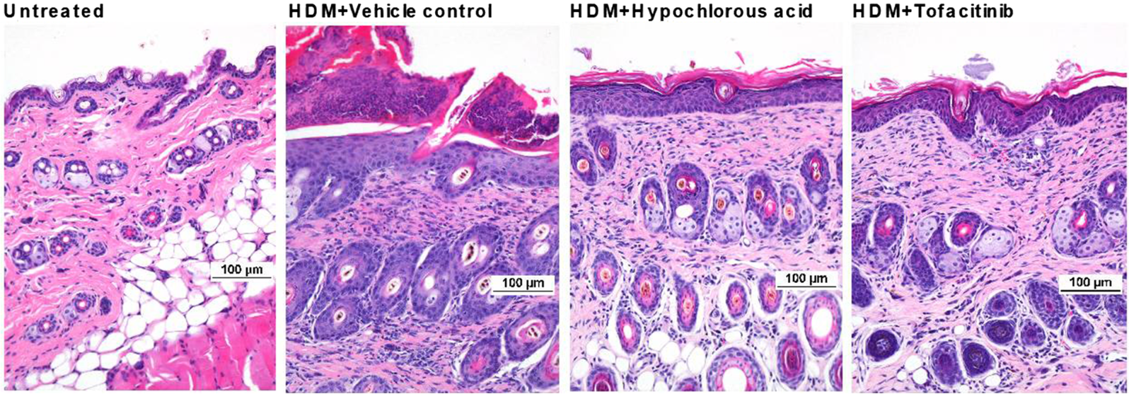 Comparison of topical tofacitinib and 0.1% hypochlorous acid in a murine atopic dermatitis model